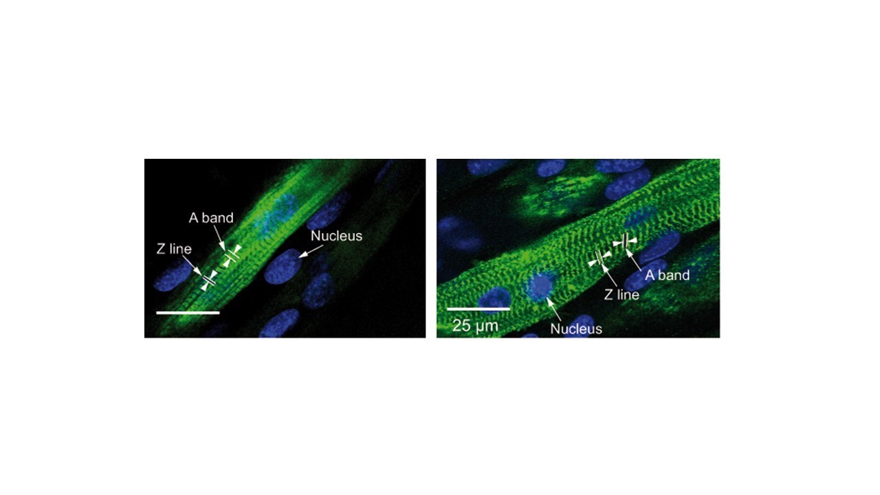 Bild:muscle-cells-sarcomers