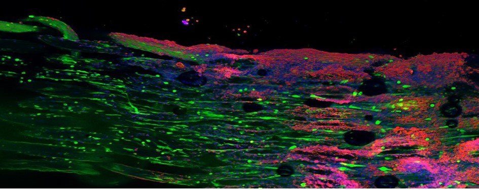 Bild: muscle-tendon-interface