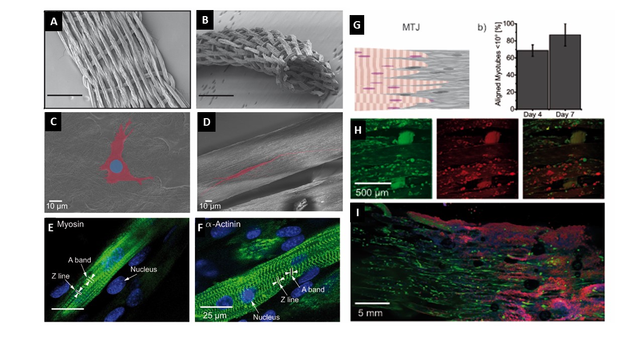 Muscle-Tendon junctions